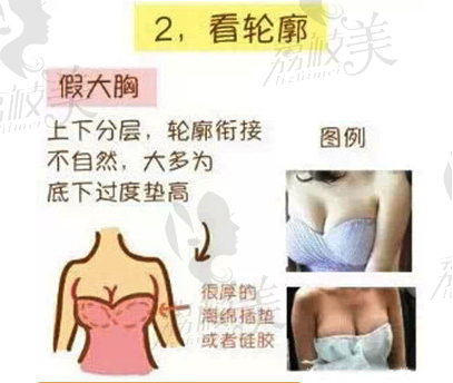 真胸和隆胸的区别看轮廓