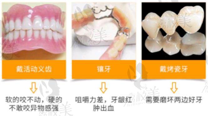荔枝美：长沙中诺口腔医院 戴活动义齿、镶牙、戴烤瓷牙的坏处