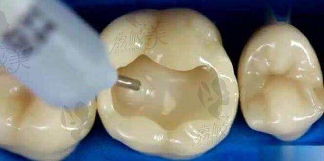 北京 西尔口腔牙齿修复