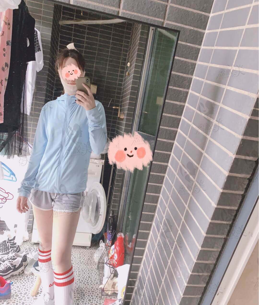 术后一个月
