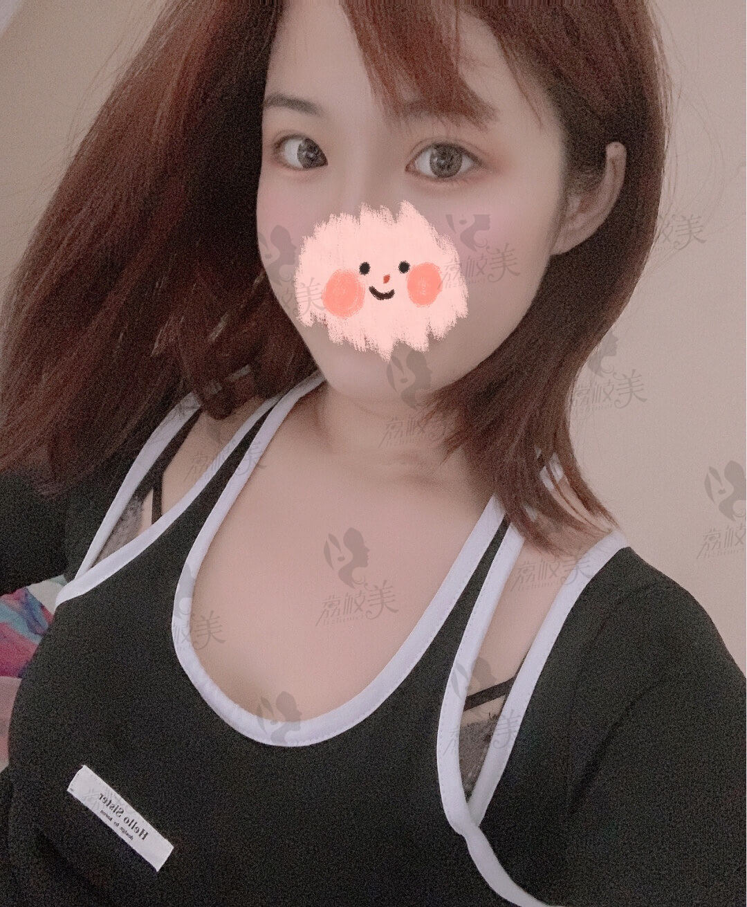 术后四个月