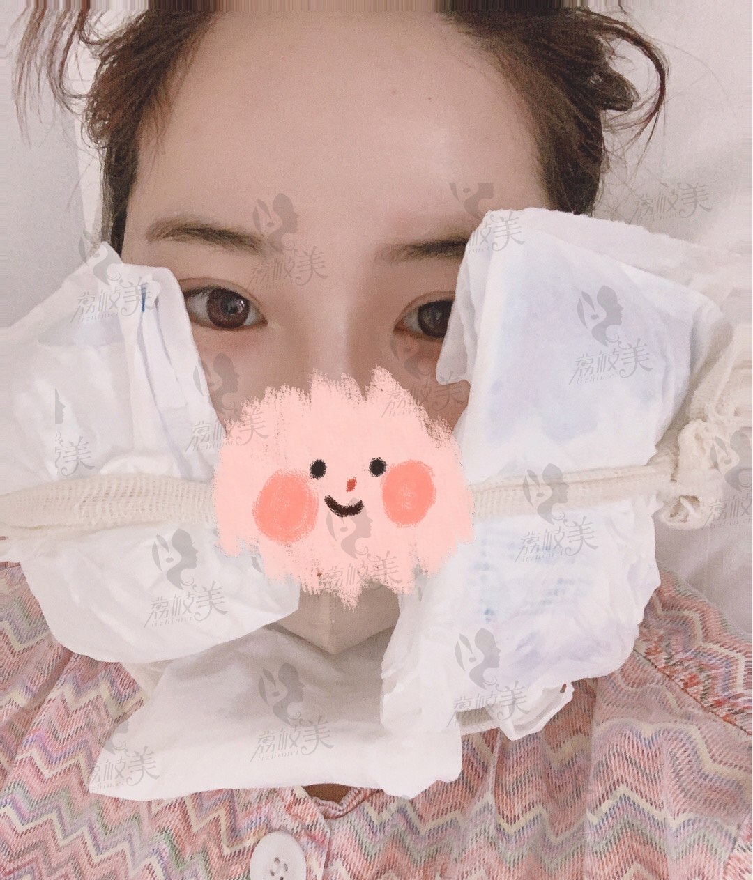 术后冰敷消肿