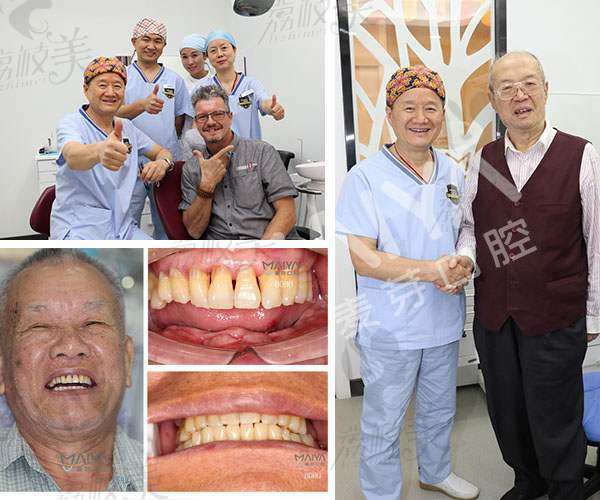 郑苍尚教授全口无牙颌ALL-ON-4种植牙案例分享