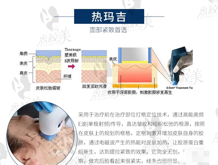 荔枝美：热玛吉