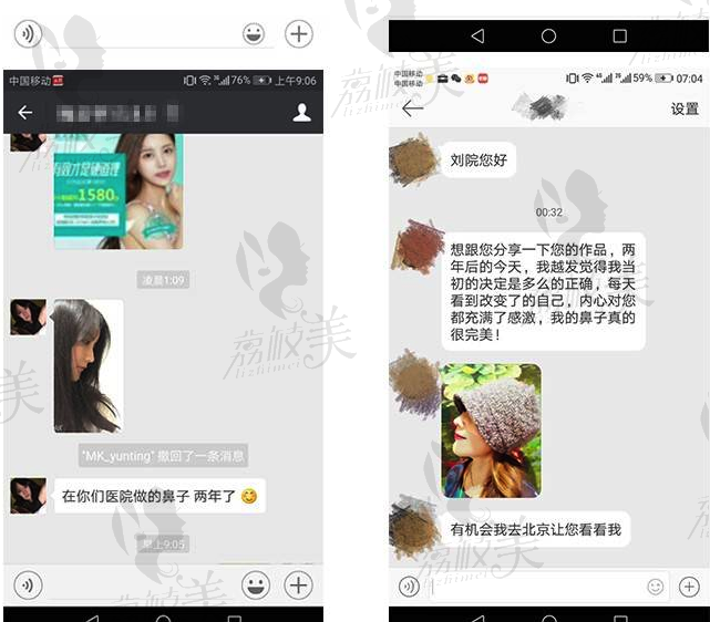 刘彦军隆鼻求美者两年后微信反馈