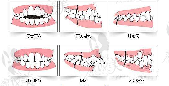 看看你的牙齿有以下哪种问题？