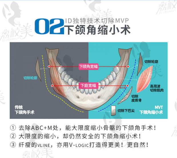 韓國ID輪廓四件套.jpg?x-oss-process=style/lzmei