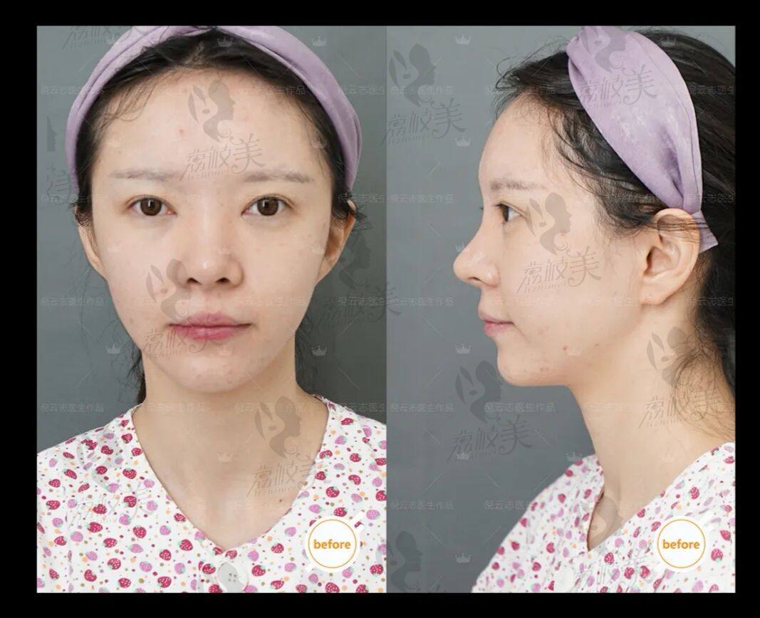 潍坊华美医疗整形美容医院