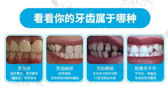 看看你的牙齿属于哪种？