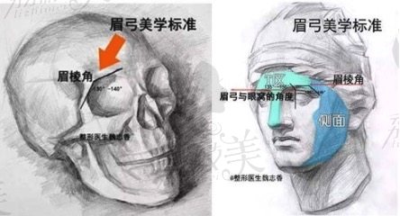 北京麗星魏志香NER硅膠墊眉弓