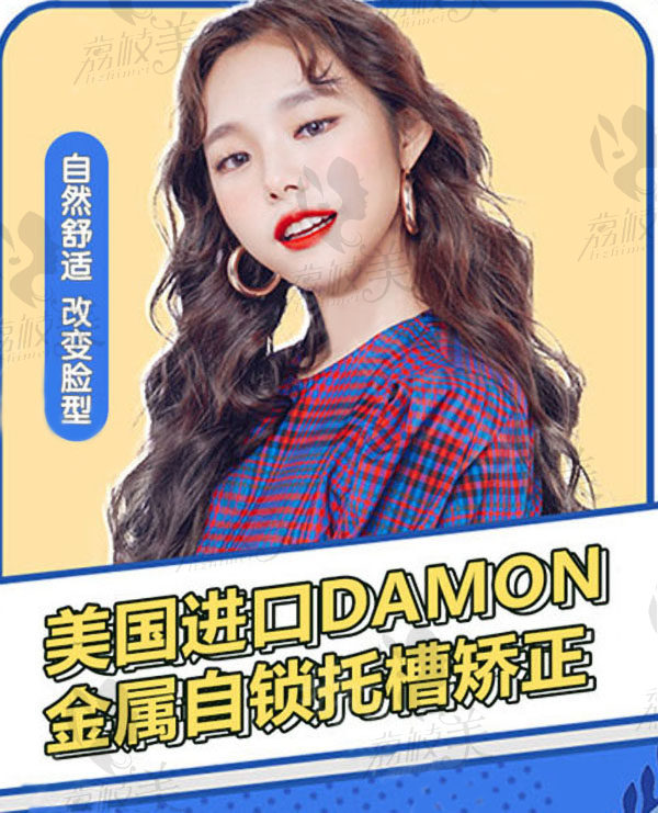 美国进口DAMON金属自锁托槽矫正