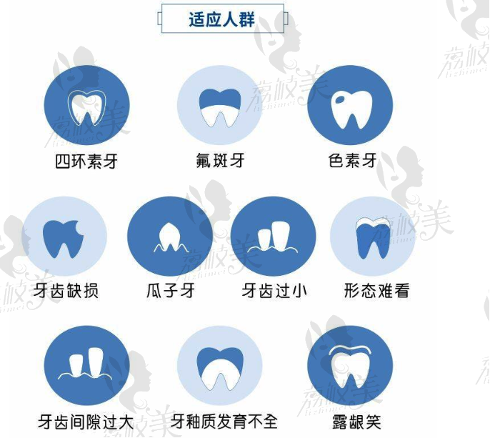 瓷貼面適應(yīng)的人群