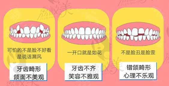 深圳美奥口腔时代天使隐形矫正效果好不好?大概价位是多少?