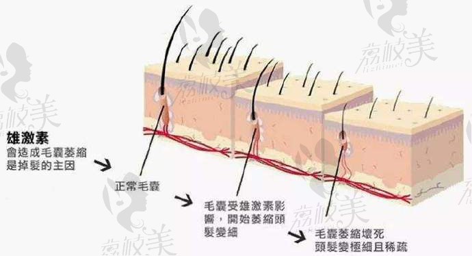 北京南加整形美容門診部唐道臣植發(fā)