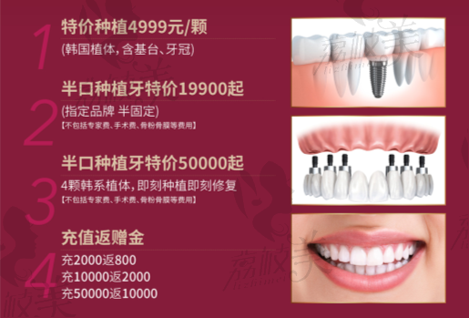 上海雅悦齿科种植活动内容