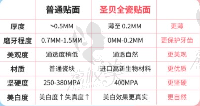 西安圣贝瓷贴面优势