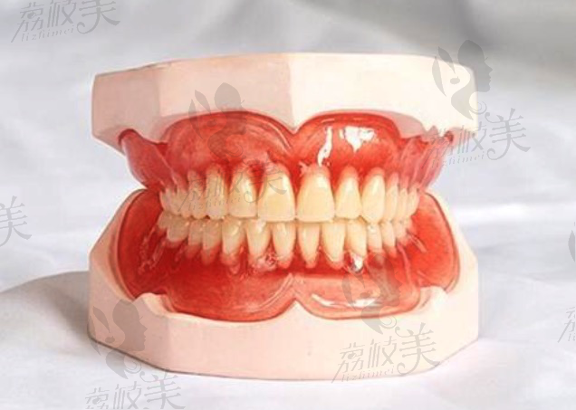 贵阳德韩口腔BPS吸附性义齿三大技术,告别不舒适假牙！