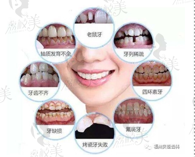 福州贝臣齿科：几只常见牙齿问题照片