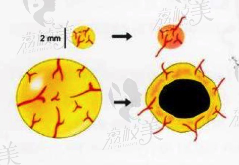 增加脂肪球的存活率的注意要点