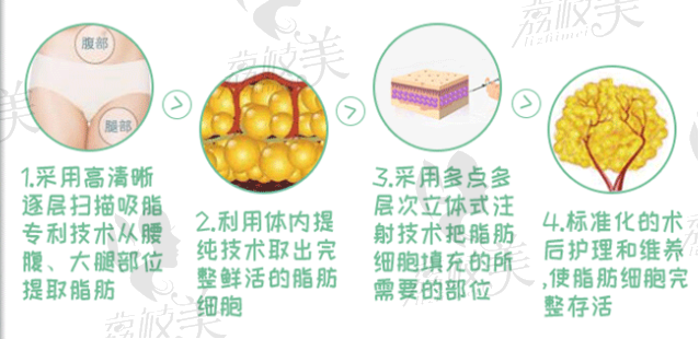 馮斌吸脂過(guò)程