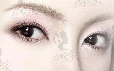 常州美莱医疗美容韩 式双眼皮的线条自然，效果持久，伤口小