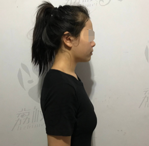 南昌方大戴洪芸丰胸前照片