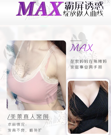 美萊MAX霸屏胸案例