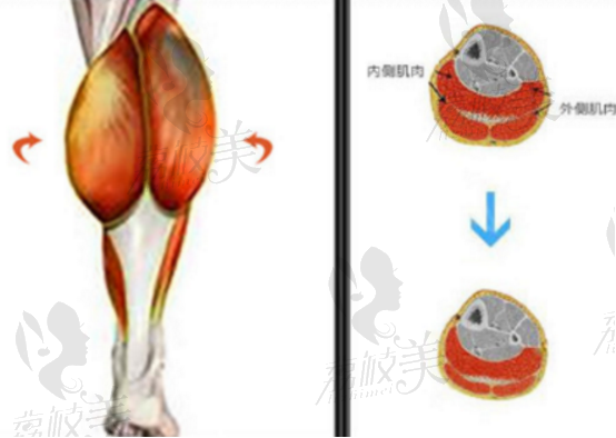 瘦腿肌肉展示