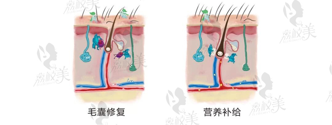 北京南加南唐道臣医生解锁植发是怎么植上去的?植发靠谱吗?