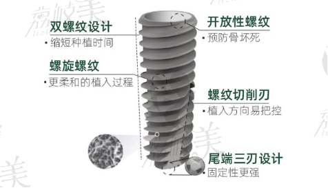 种植体设计