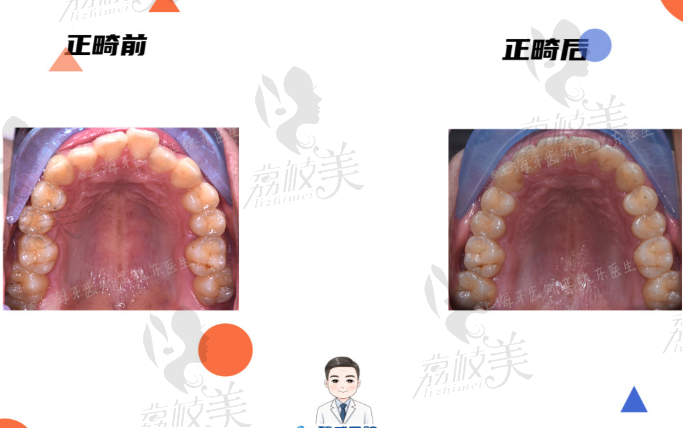 上海臻威口腔魏东牙齿矫正