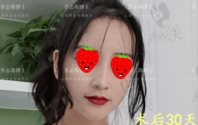 术后30天