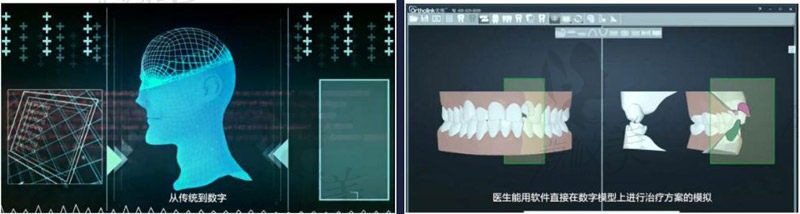 重庆维乐口腔医院优势