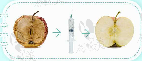 深圳艺星玻尿酸