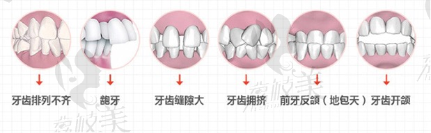 福州格萊美口腔極速牙齒矯正