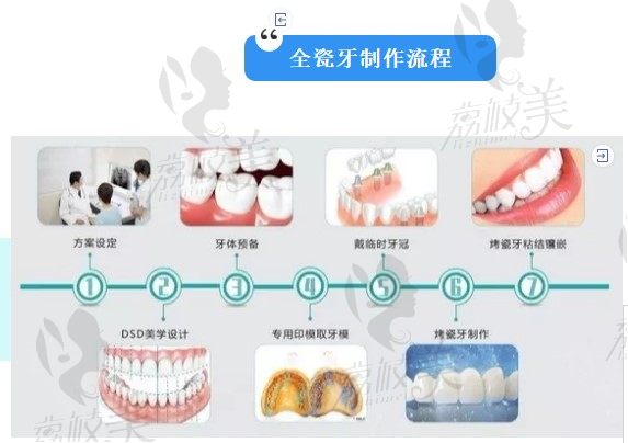 全瓷牙制作流程