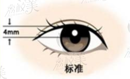 重庆联合丽格双眼皮瞳孔间距