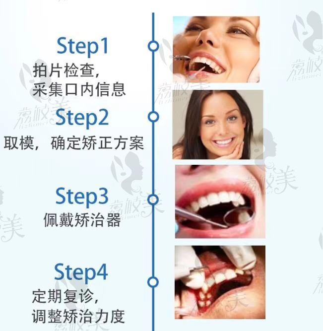 深圳圣浩齿科时代天使隐形矫正