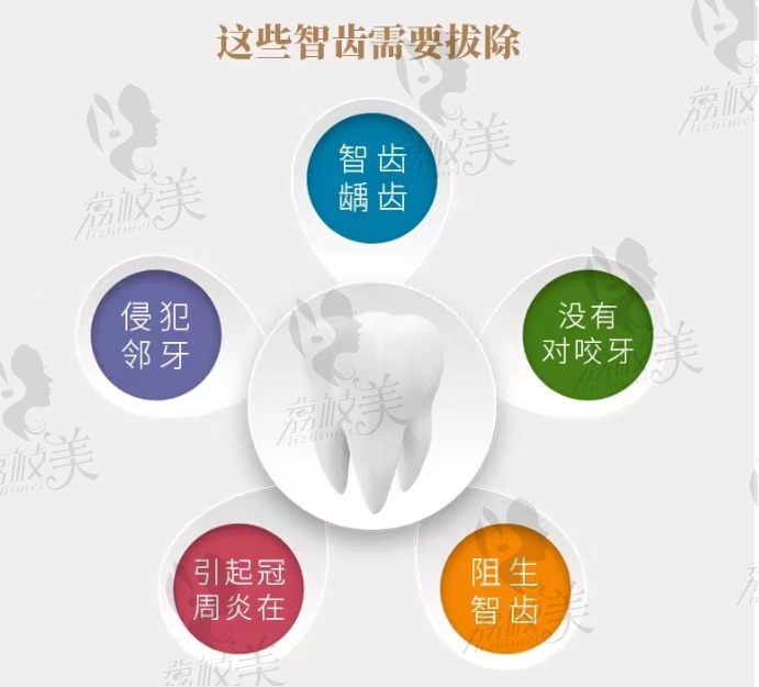 蘭州牙王國(guó)口腔下頜長(zhǎng)規(guī)智齒拔除.微創(chuàng)拔牙