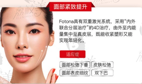 深圳艺星的欧洲之星fotona 4D效果