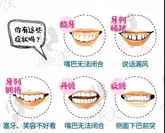 牙齿的几个常见问题