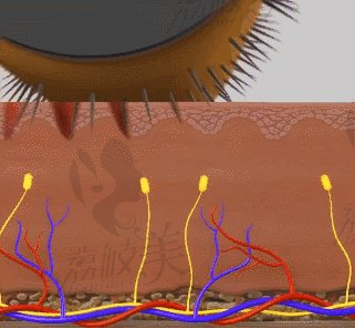 上海伊莱美昕芙丽胶原蛋白＋微针