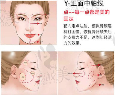 上海艺星医疗美容医院美容外科院长肖英面部提升