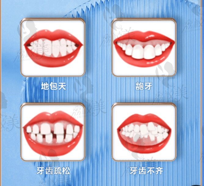 深圳慈恩牙齿矫正歪牙正畸方案设计