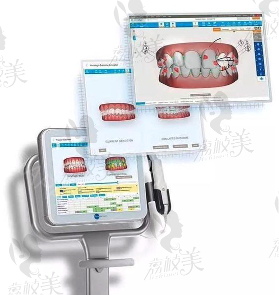 东莞好佰年口腔3Dshape数字化口腔扫描仪
