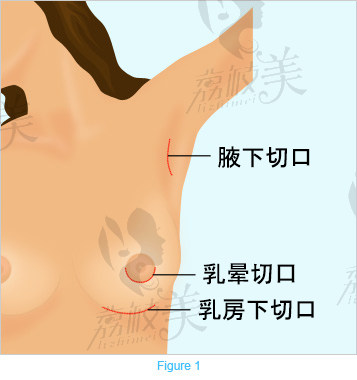 泰國(guó)然禧（Yanhee）整形醫(yī)院Chockchai醫(yī)生