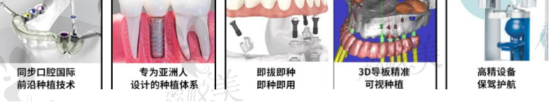 精准”即可用“种植牙技术