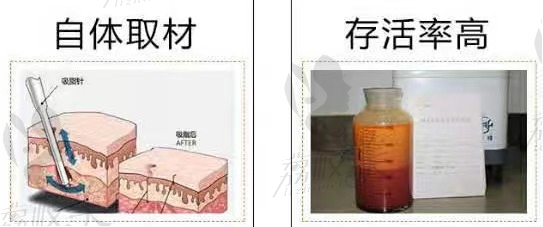 自体取材