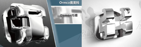 极光Ormco自锁托槽矫正
