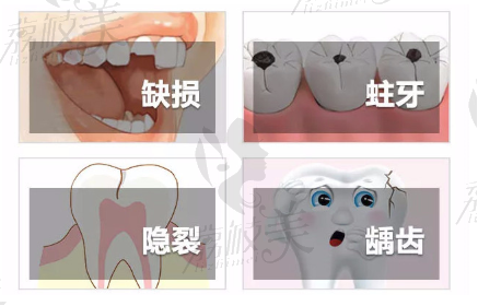 常见牙齿问题